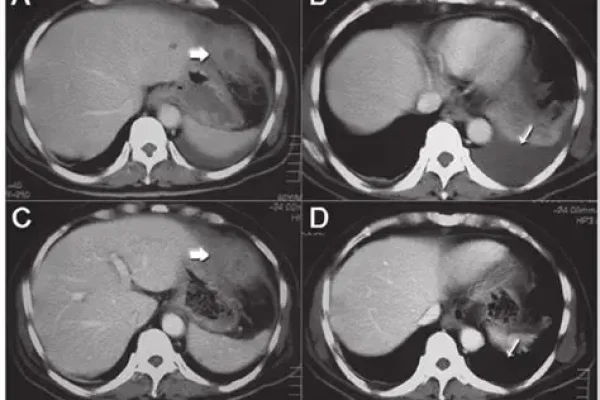 Computed Tomography (CT)​