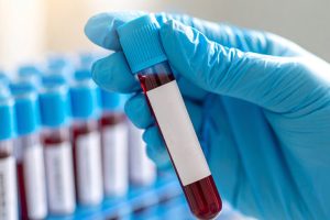 blood test banner