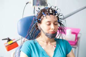 ecg