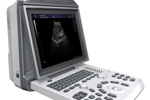 ultrasound1